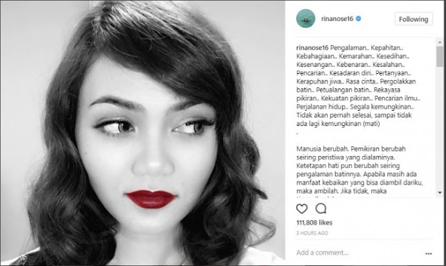 Viral Karena Keputusannya Untuk Melepas Hijab, Toko Busana Muslim Rabbani Gratiskan Jilbabnya Untuk Rina Nose