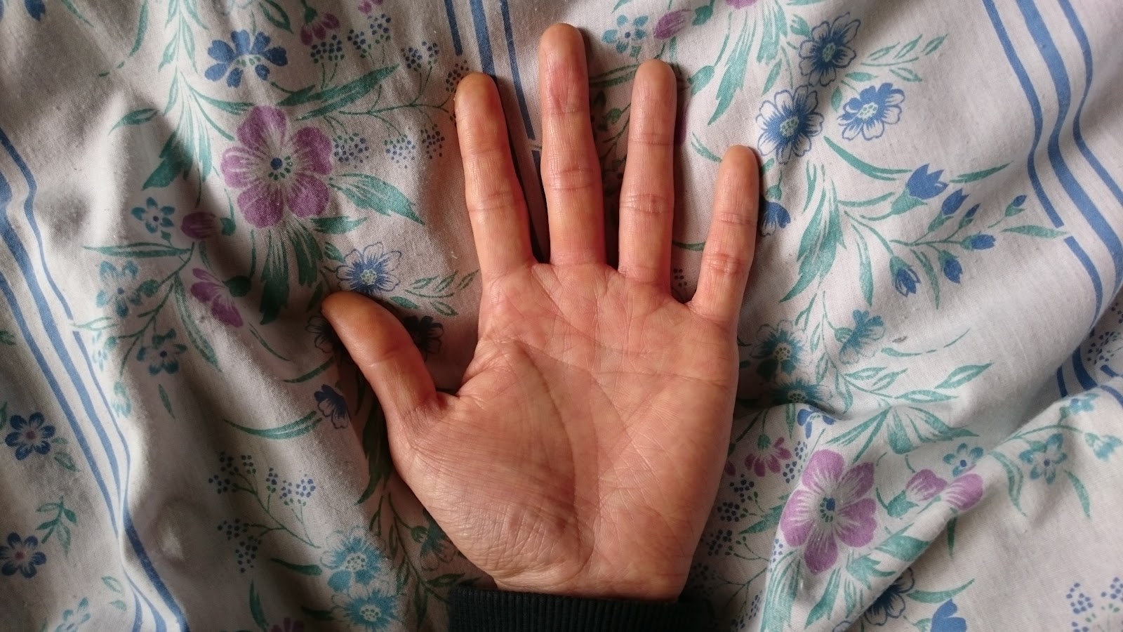 ホロコースト（ユダヤ人の絶滅）