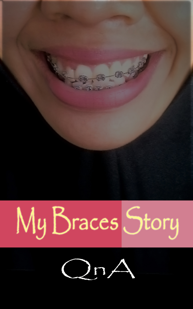 My Braces Story (Pasang behel di Kediri) IMA'S STORIES