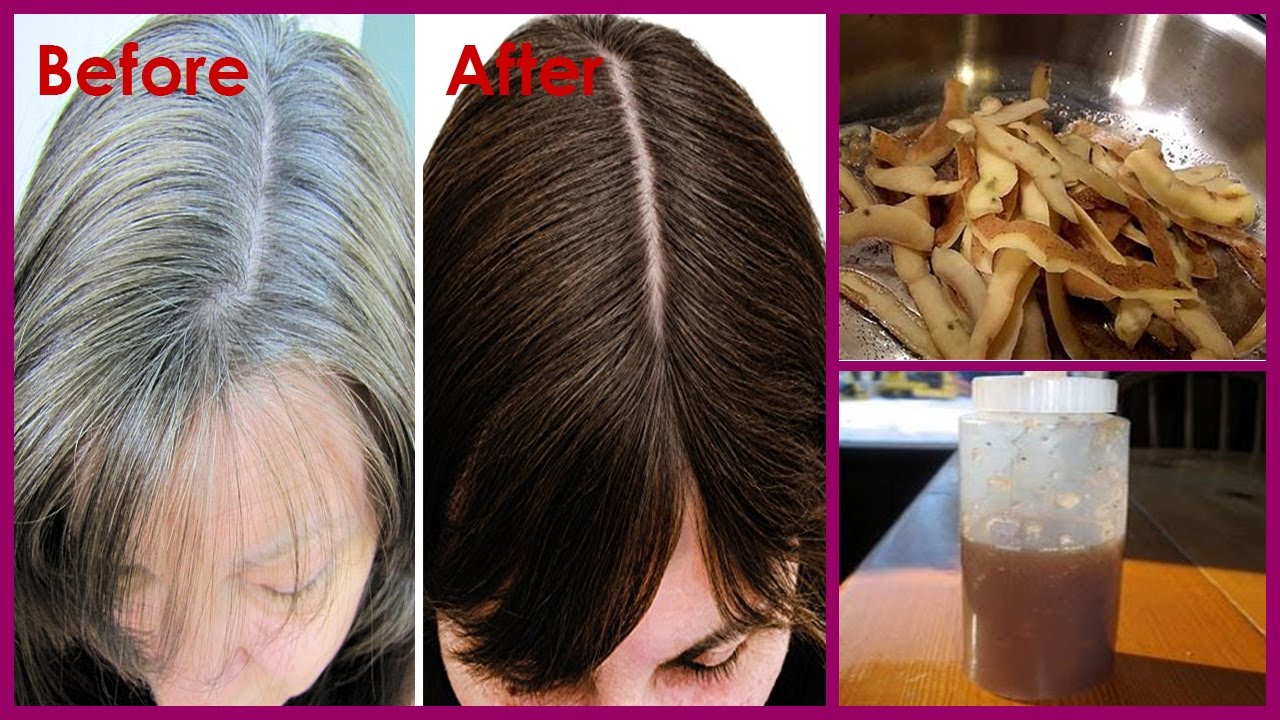 Get Rid of Gray Hair Naturally With Potato Skins Chefs Collaborative