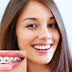 Niềng răng không nhổ răng, trường hợp nào nên áp dụng?