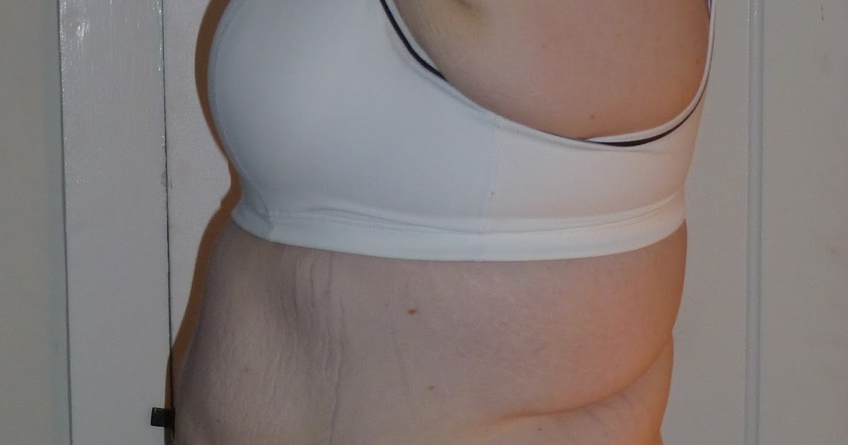 tummy tuck month