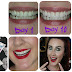 Oral B 3D White Whitestrips Review & Results