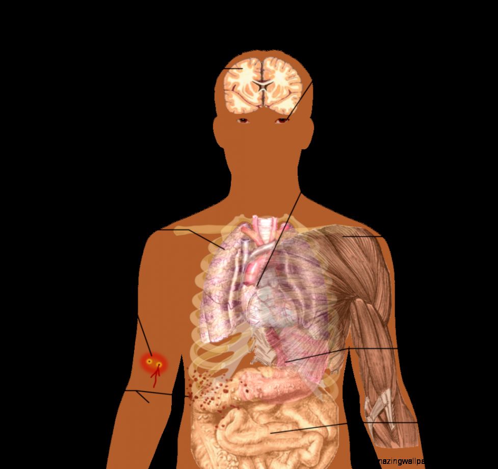 FileSnake bite symptoms   Wikimedia Commons