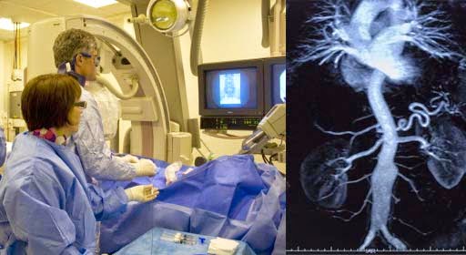 Interventtional Radiology