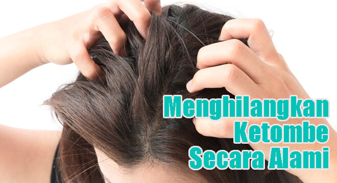 Cara Ampuh Menghilangkan Ketombe Cara Ampuh Menghilangkan Ketombe