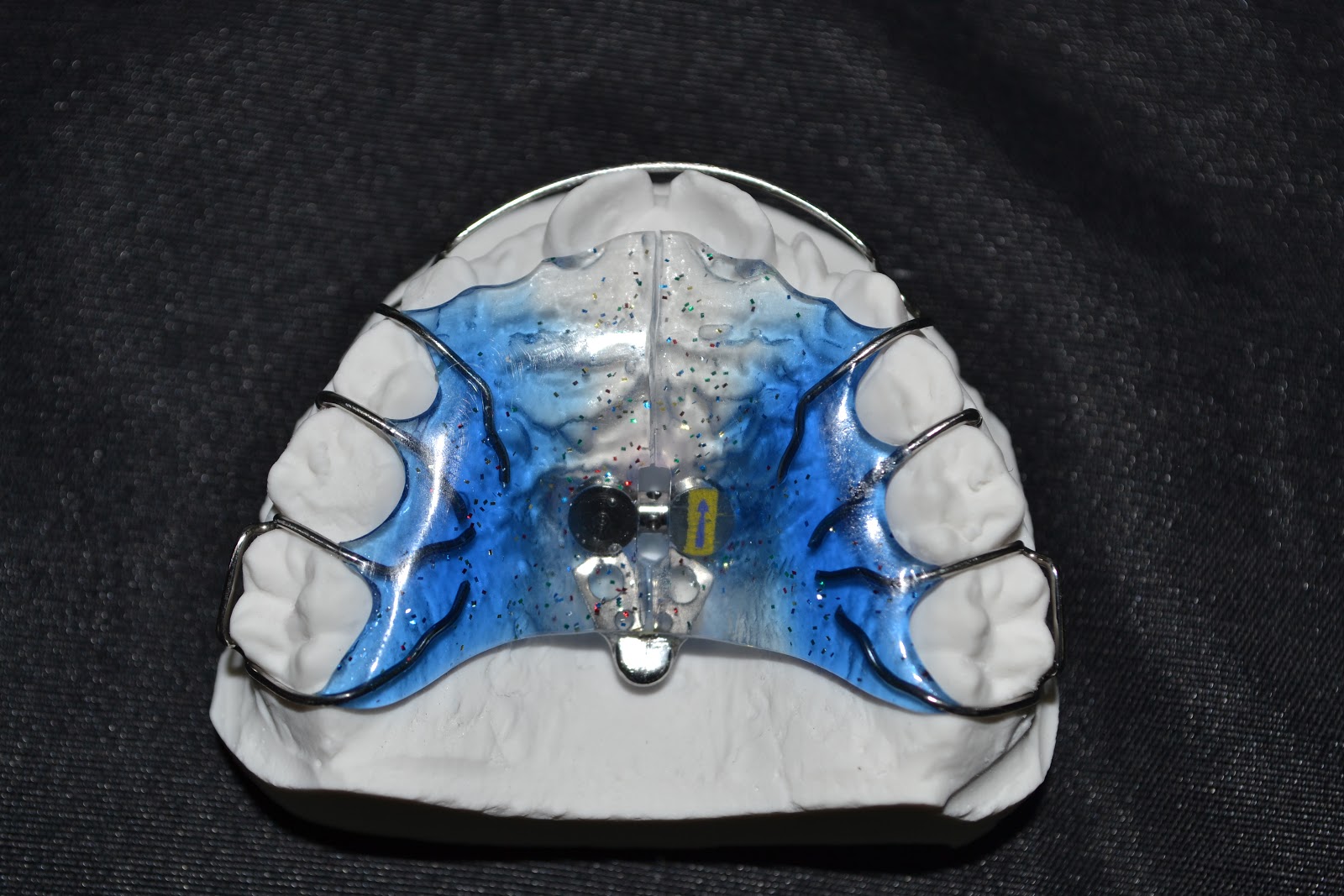 Laboratorio Ortodontico MRdental PLACCA DI SCHWARZ CON VITE VENTAGLIO