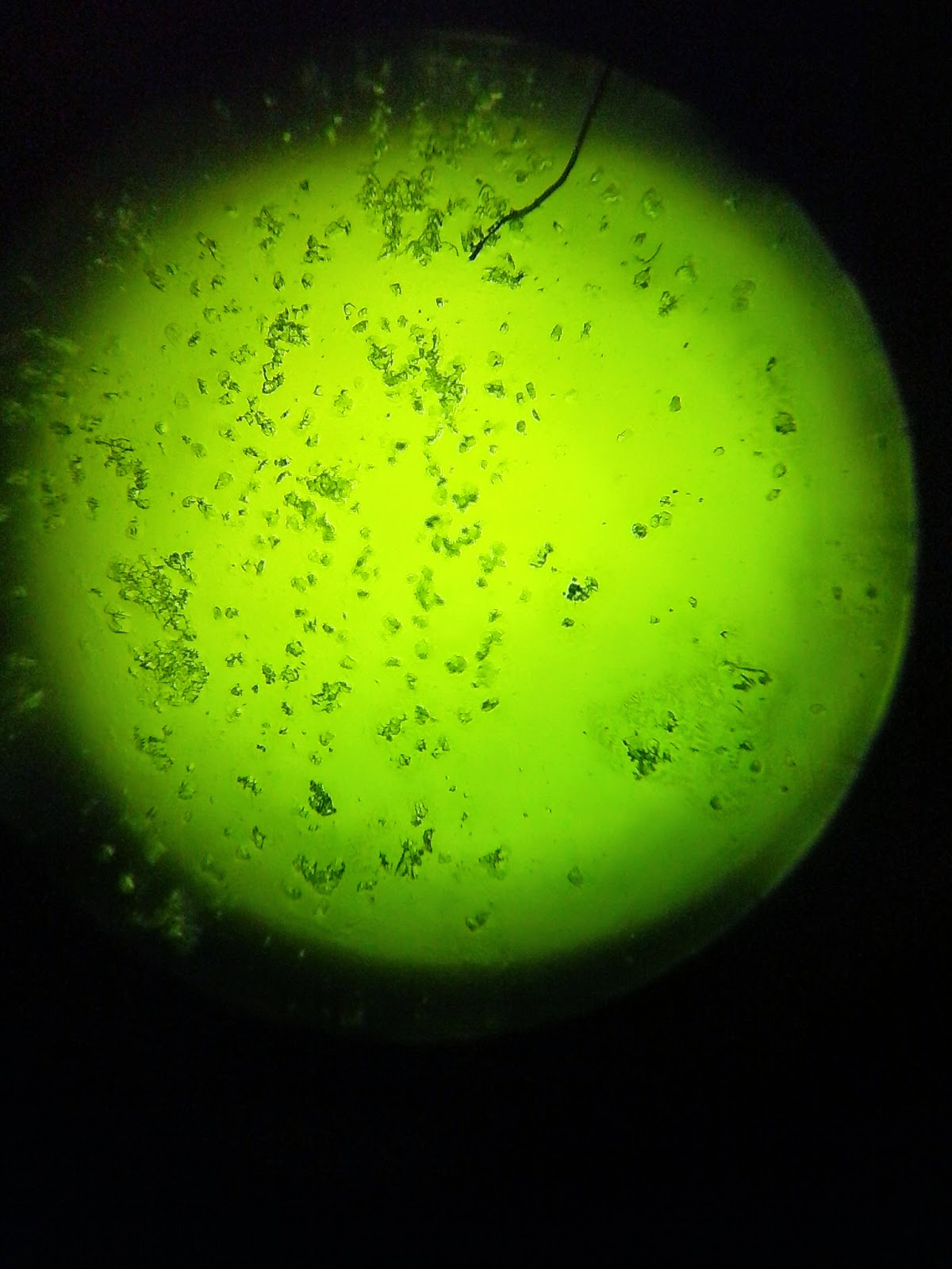 ttc-with-saliva-microscope-day-by-day-ferning-maybe-baby-saliva