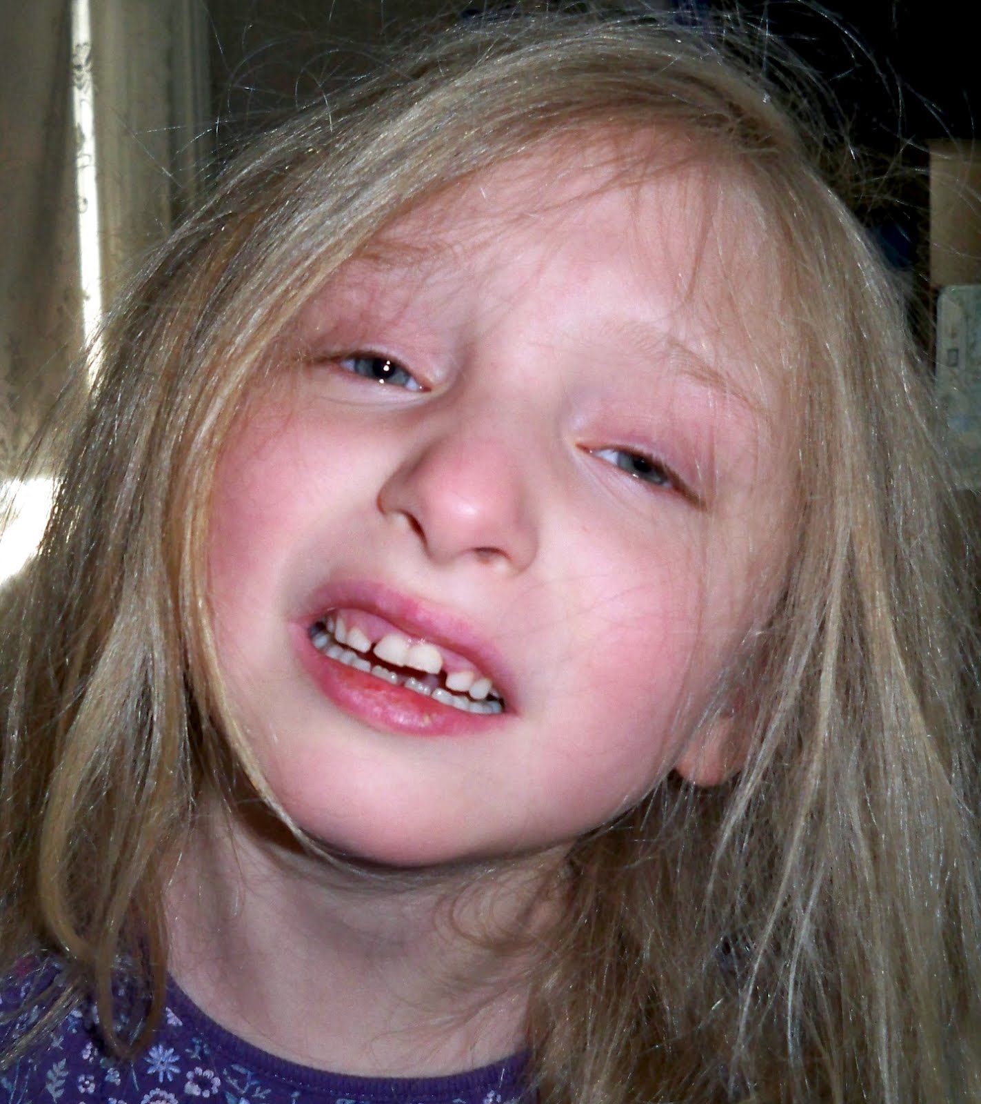 Rarer In Girlsmy Daughter With Autism Sad To Happy 5FC