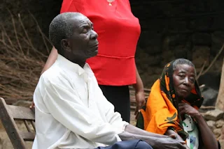 Man in Tanzania Africa with River Blindness.