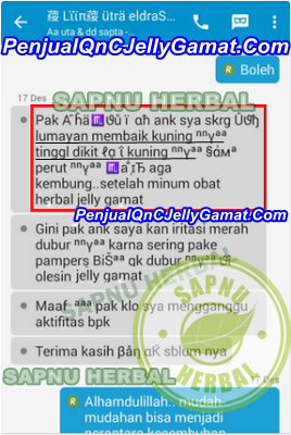 Cara Mengobati Penyakit Kuning Pada Orang Dewasa dan Anak-anak, Terbukti Manjur Cara Mengobati Penyakit Kuning Pada Orang Dewasa dan Anak-anak, Terbukti Manjur