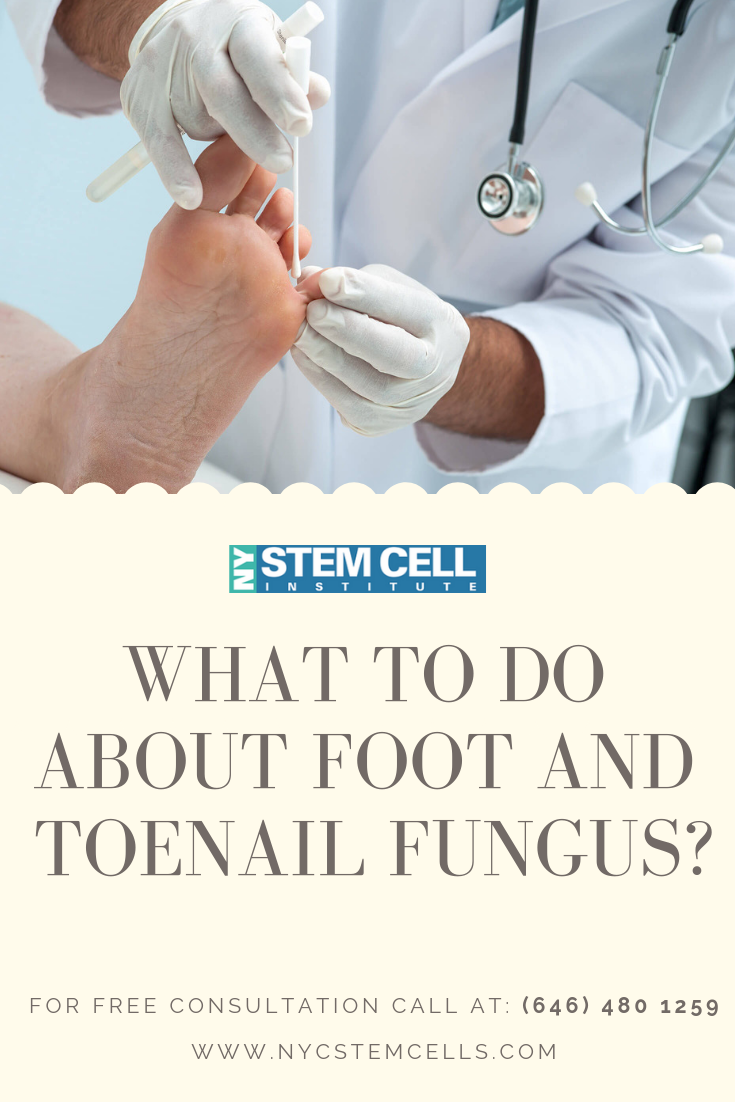 Podiatrists in New York Ways To Treat Toenail Fungus Suggested By