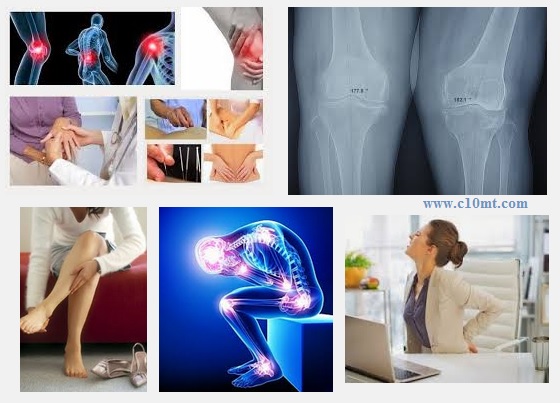 Biện pháp phòng tránh đau xương khớp mỏi cơ