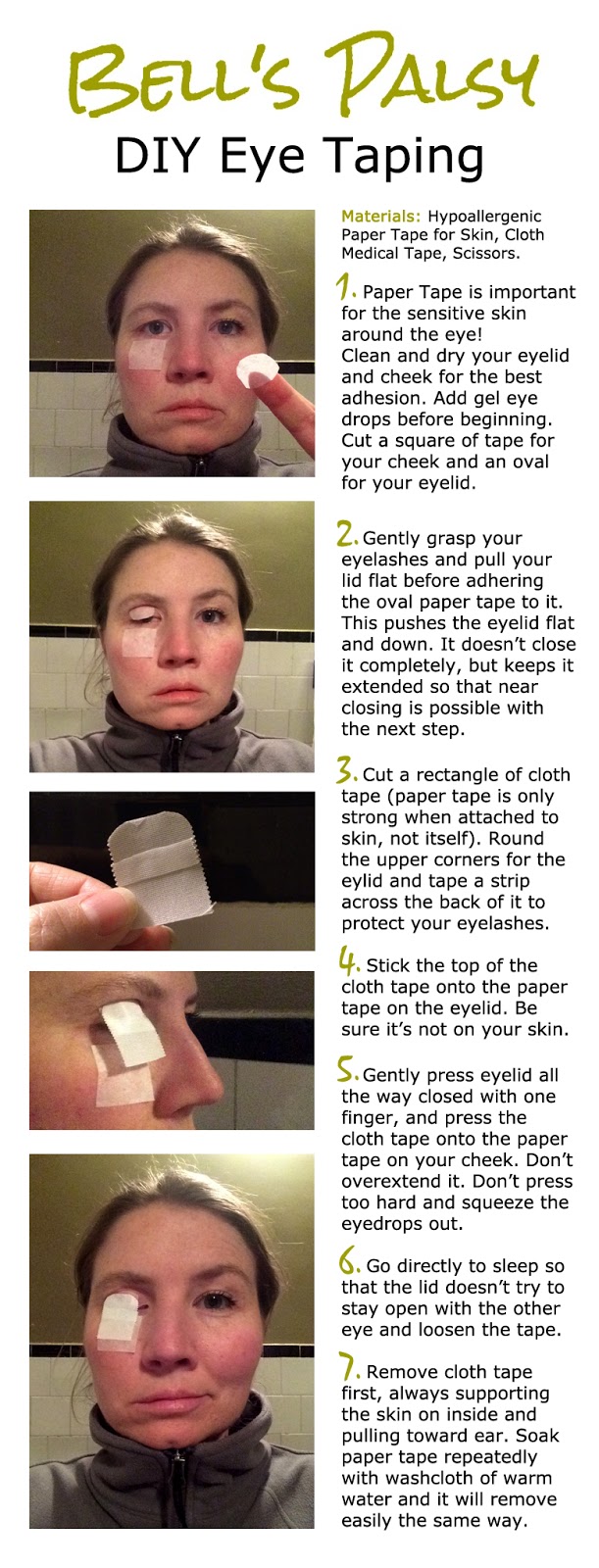 Days 1314 DIY Eye Taping