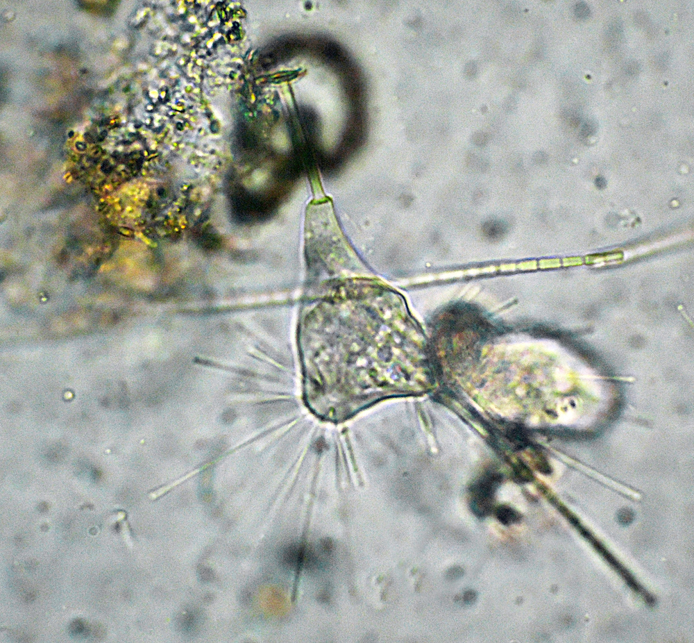 Il Microscopio: INFUSORI TOKOPHRYA