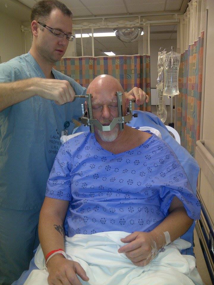 Trigeminal Cephalalgia Neuralgia aka Cluster Headache Suicide Headache