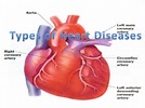 Types of Heart Disease and How to Treat Them