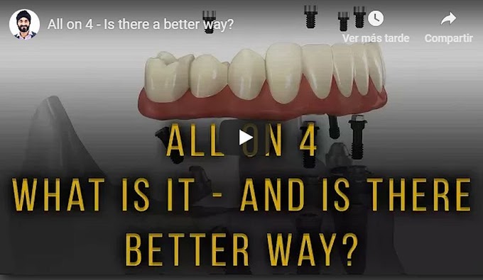 IMPLANTOLOGY: All on 4 - Is there a better way? - Dr. Gurs Sehmi