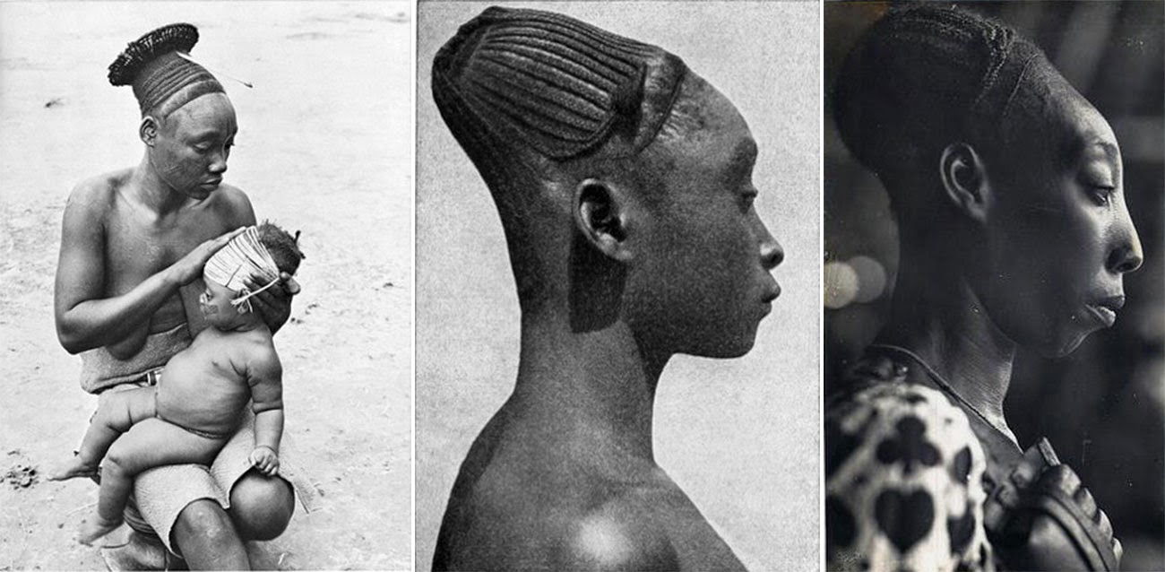 This skull deformation was created by tying cloth around the head of the baby right from birth, while the cranial bone is still soft.
