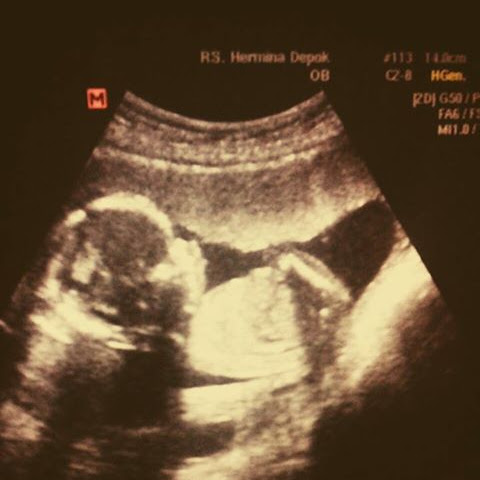 Balada Pencarian Dokter Kandungan SpOG