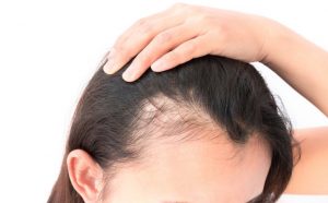 Be Beautiful Beyond Fifty Menopause Hair Loss And How You Can