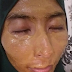 Masker Avokado Kesan Cepat Bagi Anti Penuaan 