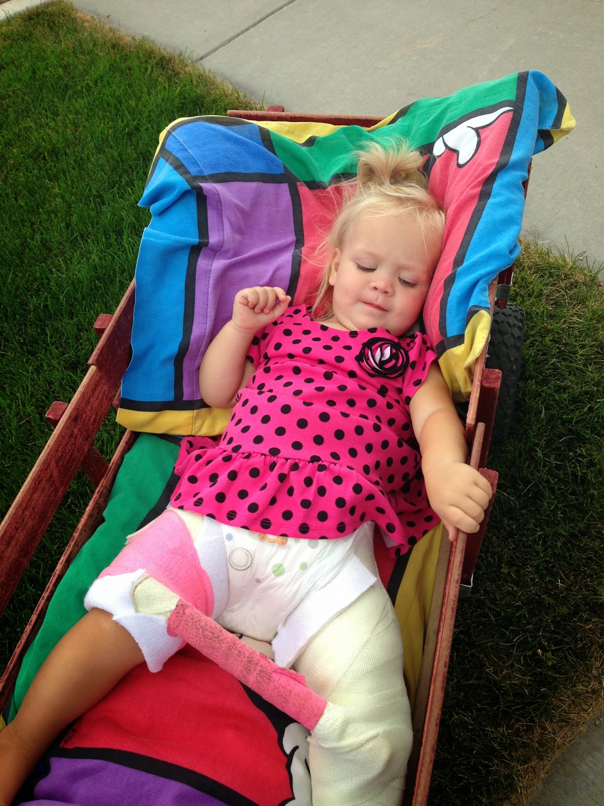 Caring for the Hip Spica Cast Coping.