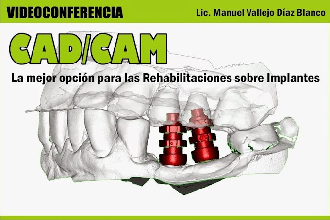 VIDEOCONFERENCIA: CAD/CAM, la mejor opción para las Rehabilitaciones sobre Implantes - Lic. Manuel Vallejo Díaz Blanco