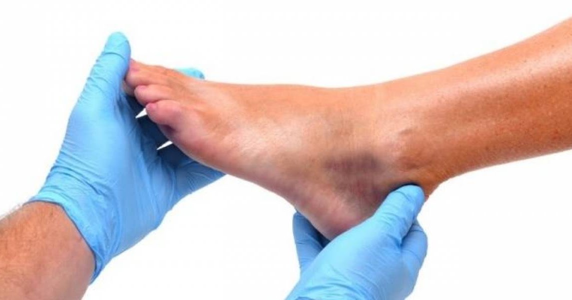 HYPERCAM Pie diabético. Oxigenoterapia Hiperbárica en el tratamiento