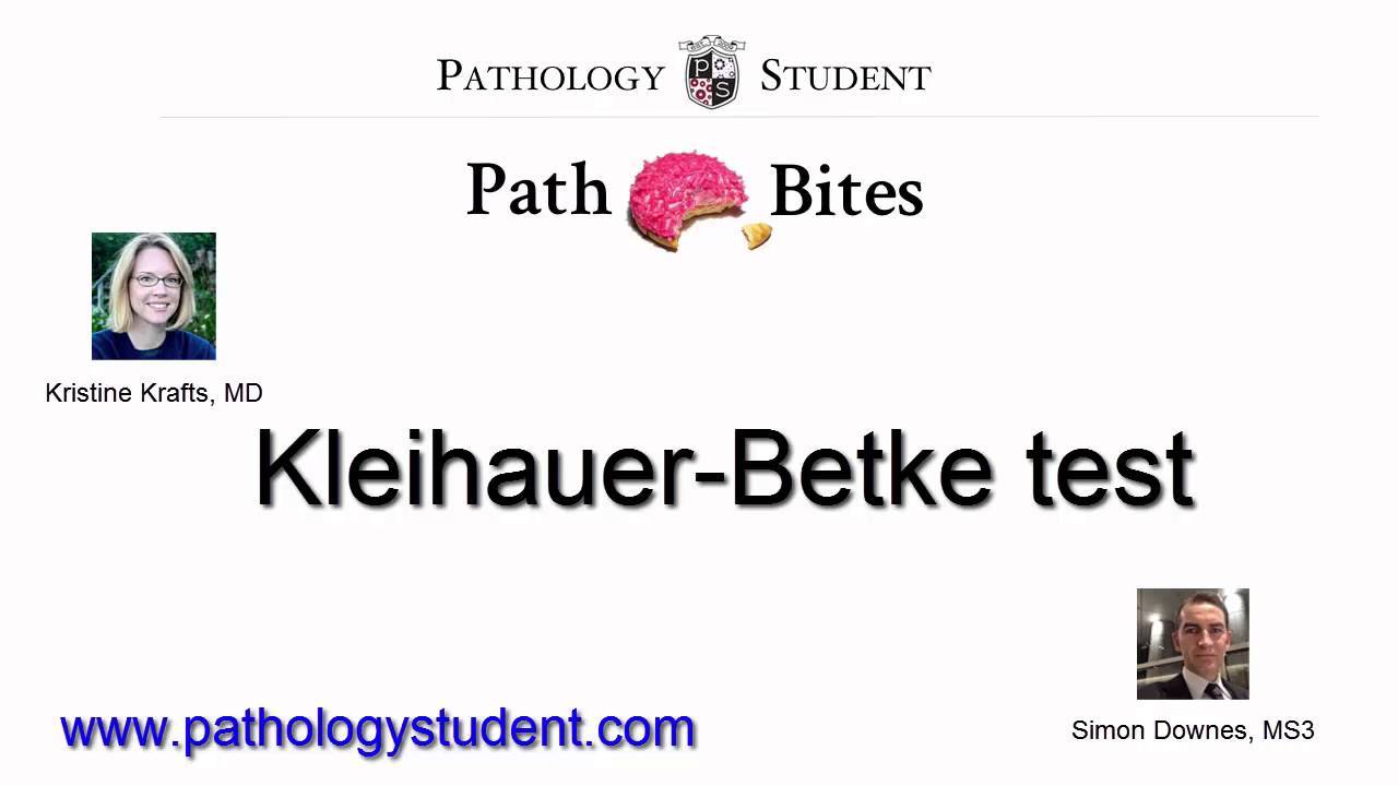 KleihauerBetke test