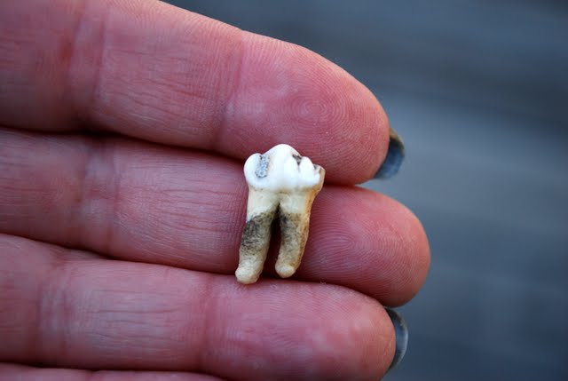 Bittersweet Bric-a-Brac: A Collection of Teeth???