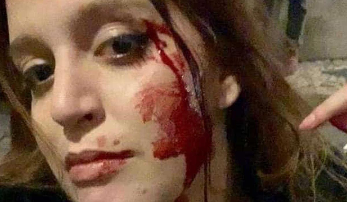 Brasileira é agredida por quatro portugueses em Lisboa: 'Impunidade total'