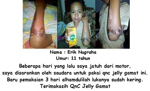 Cara Mengobati Dermatitis Atopik Secara Alami Terbukti Ampuh ~ TESTIMONI QNC JELLY GAMAT Cara Mengobati Dermatitis Atopik Secara Alami Terbukti Ampuh ~ TESTIMONI QNC JELLY GAMAT