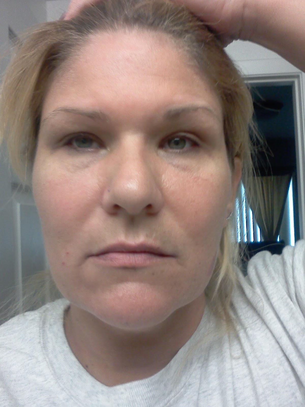 Life With Lupus Flu Like Symptoms life-with-lupus-flu-like-symptoms