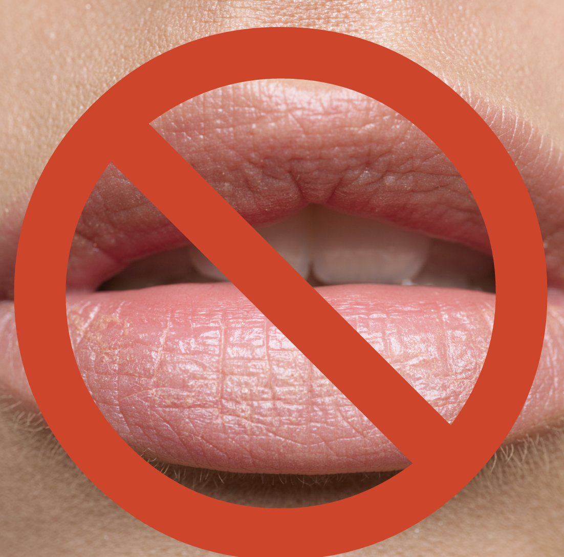 Beauty Guide Common Lip Problems And Solutions To Them