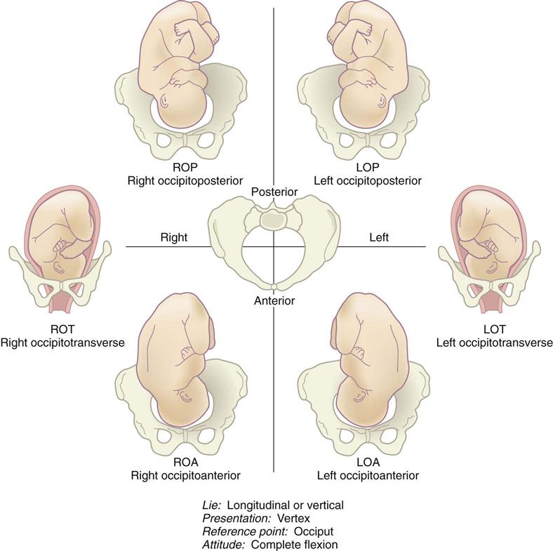 Mechanism of Labour, LOA/ROA