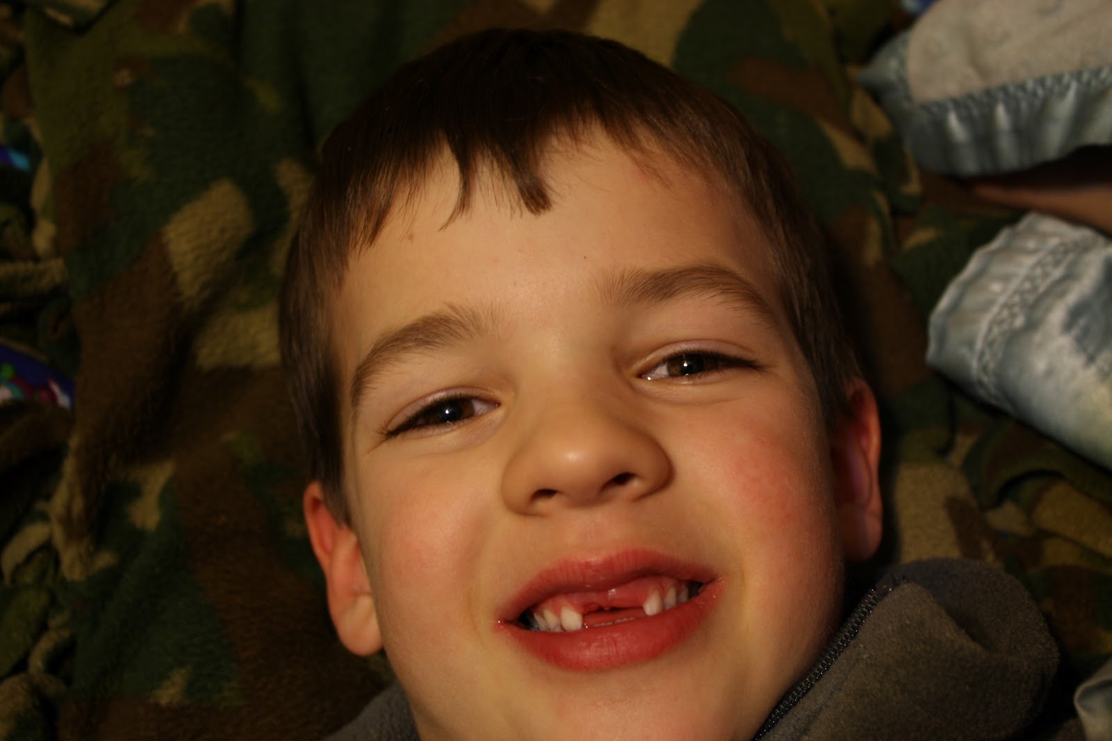 How Soon Do Kids Really Begin Missing Teeth? The Surprising Truth