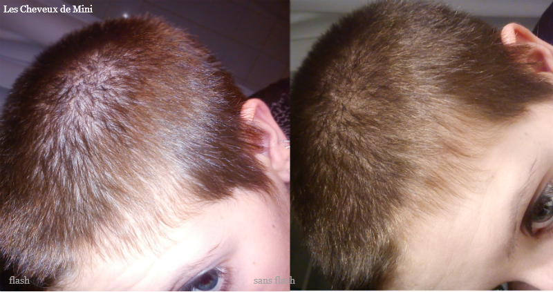 Quel Type De Cheveux Attire Les Poux Cheveux Courts Poux | Janet Charette Blog