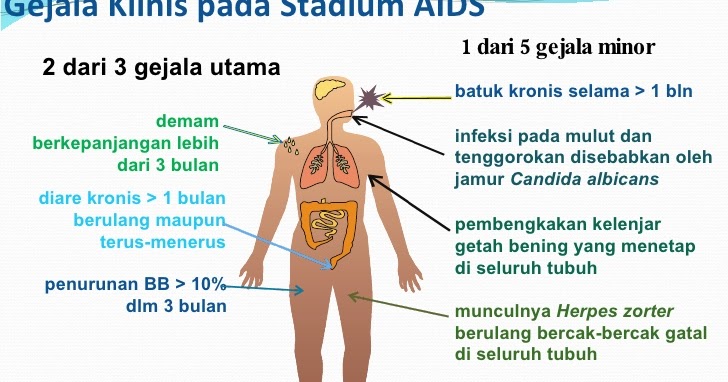 GEJALA HIV AIDS yang SERING TERJADI Terapihiv com GEJALA HIV AIDS yang SERING TERJADI Terapihiv com