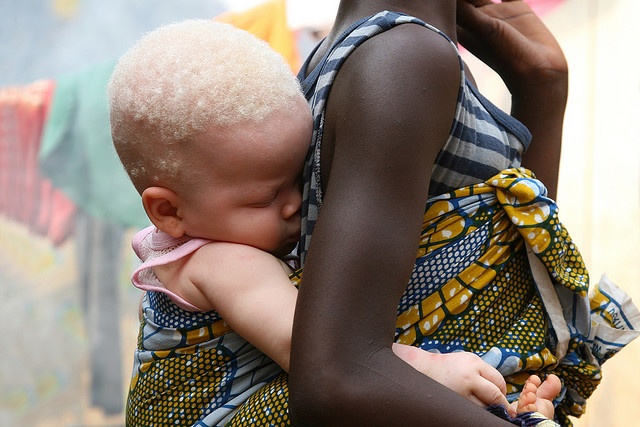 Dopo Il Verbo Amare Il Verbo Aiutare E Il Piu Bello Del Mondo Sono Nato Albino Un Bimbo Bianco In Una Famiglia Maasai
