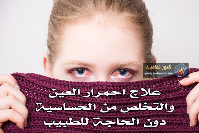 علاج احمرار العين المزمن