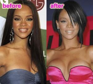 The Case For Plastic Surgery