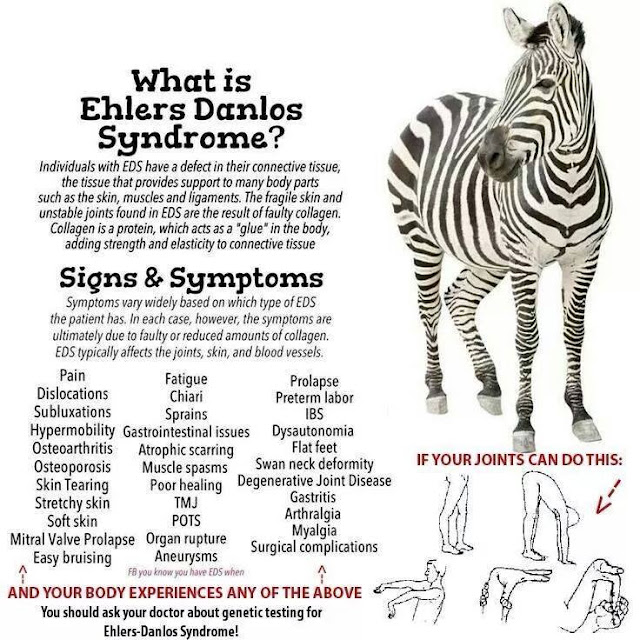 Living the Diagnosis Sometimes it is the Zebra An EhlersDanlos