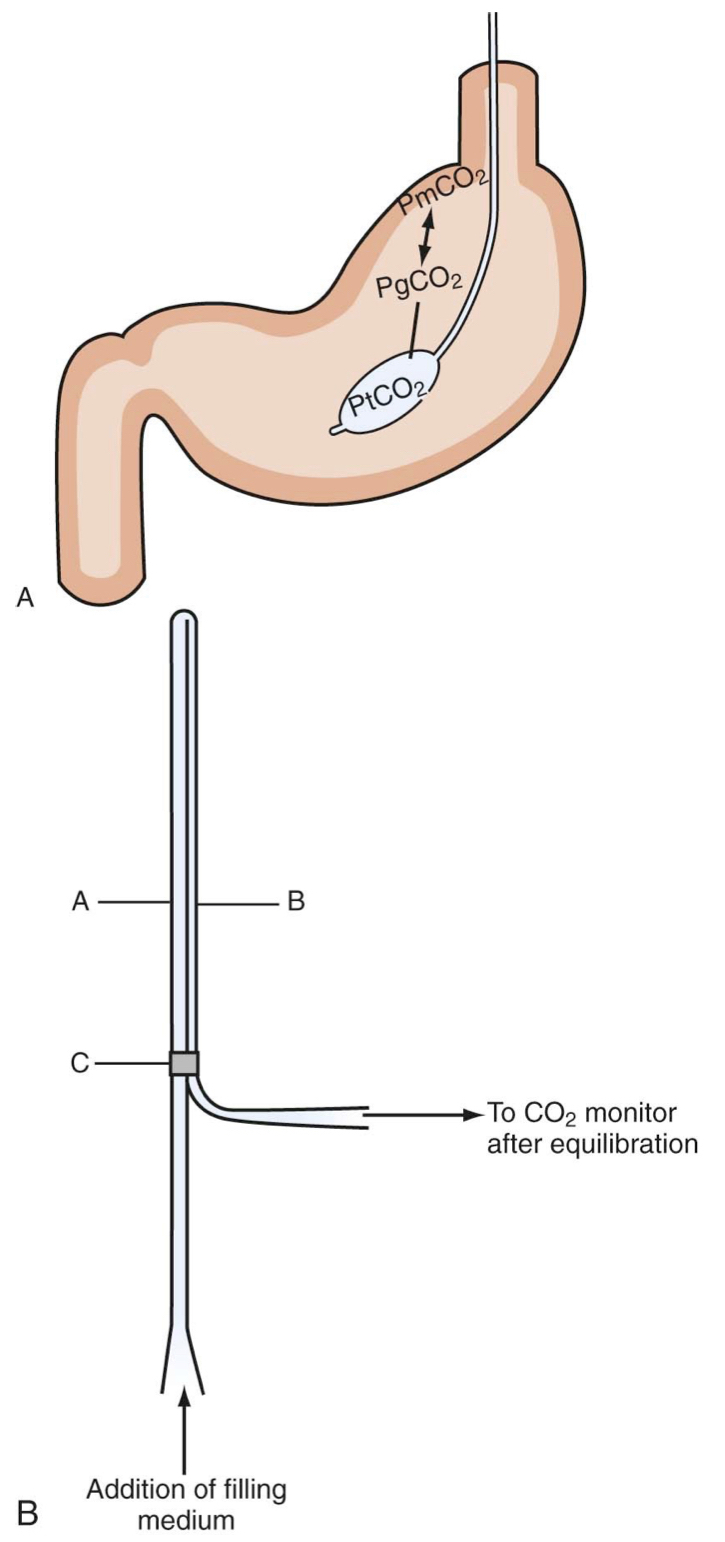 dieta per altari di proteinuria