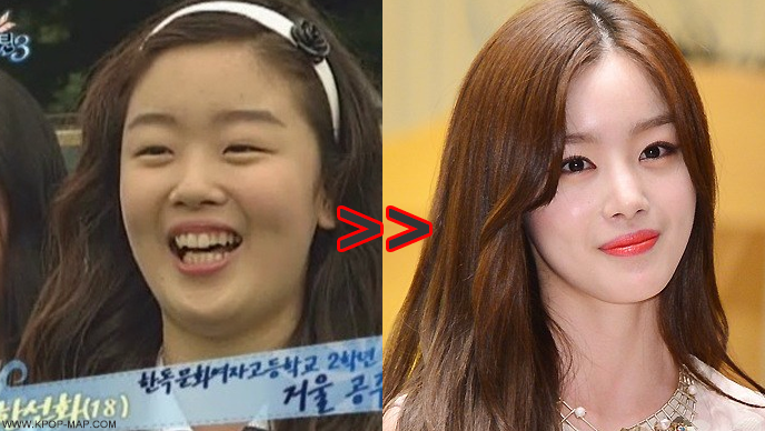 Trending News Photos About Korean Actor Actress And K Pop Group Korean Idol Plastic Surgery Transformations Photos And Videos