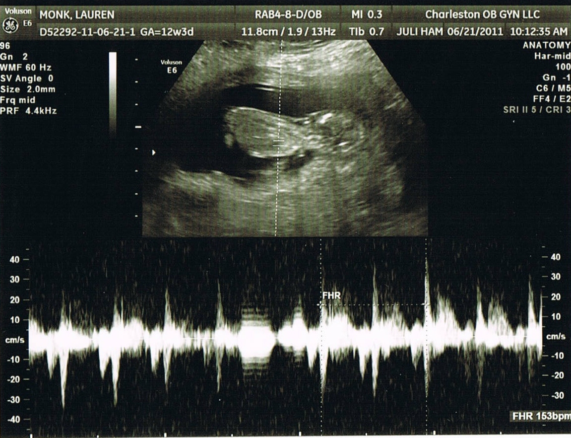 Monkey Business Is that my nose?