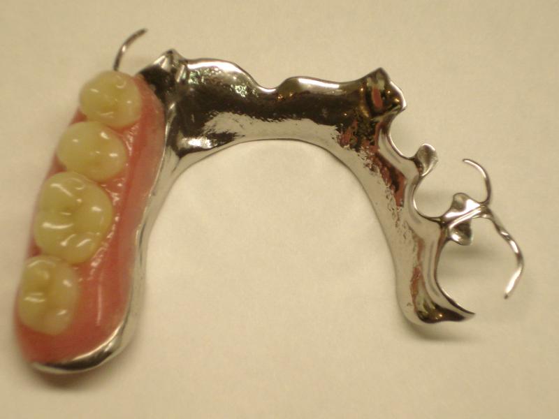 Dentistry and Medicine Partial Dentures Questions to improve your KnowledgeProsthetic Dentistry