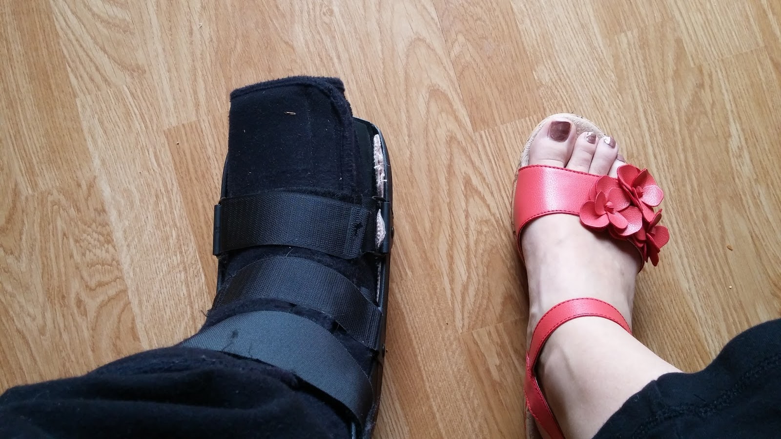 Lyme Disease and Foot Pain My Journey the Last 3 Months