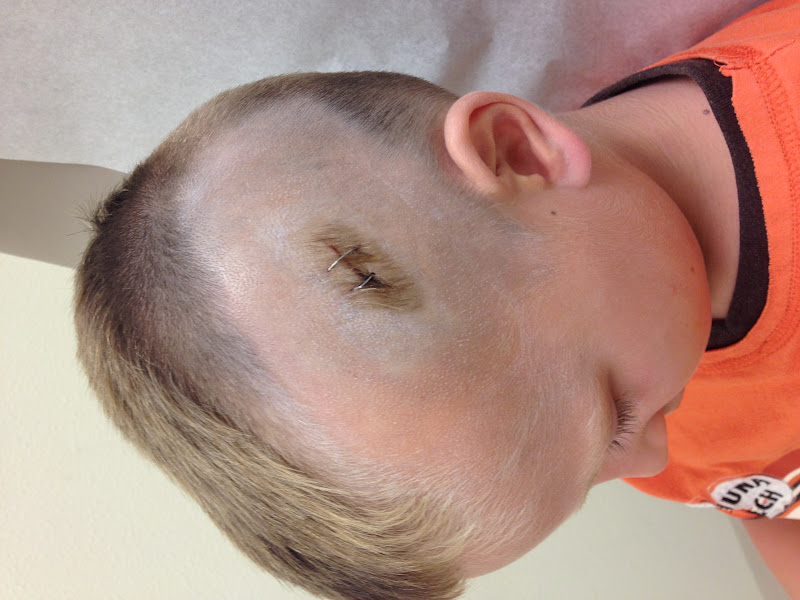 Courtright Family: Strep, Stitches, Staples, and Splinters