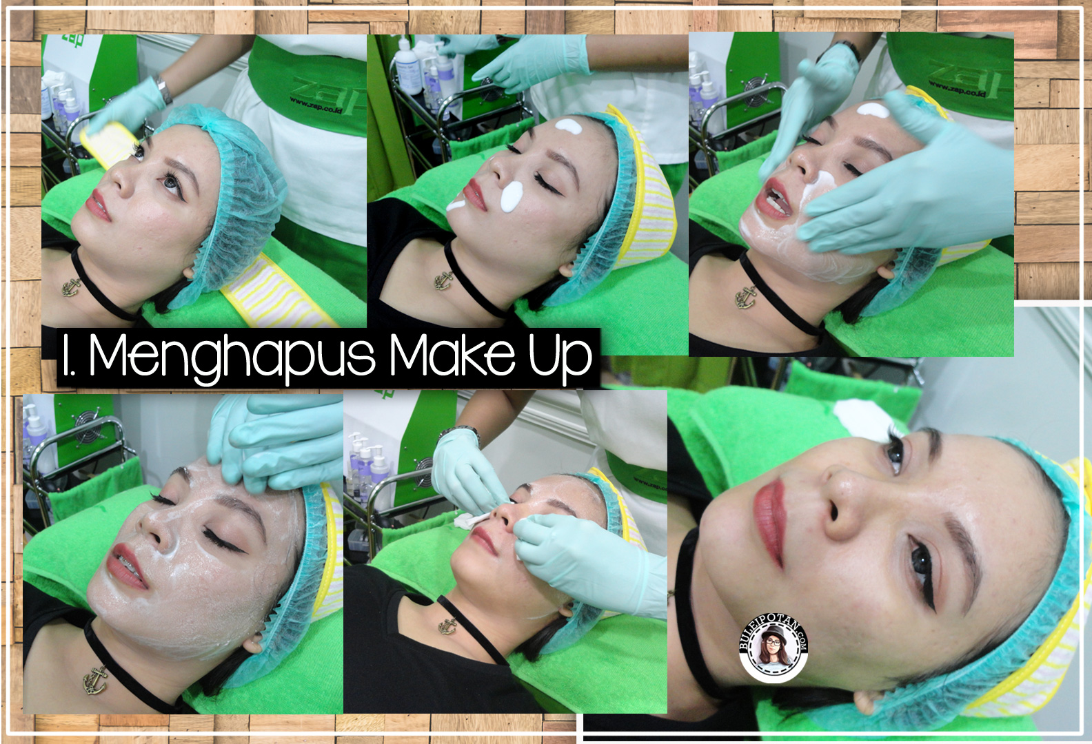 [Experience+Testimoni] Treatment Kulit pertama Bule di ZAP Menteng dan